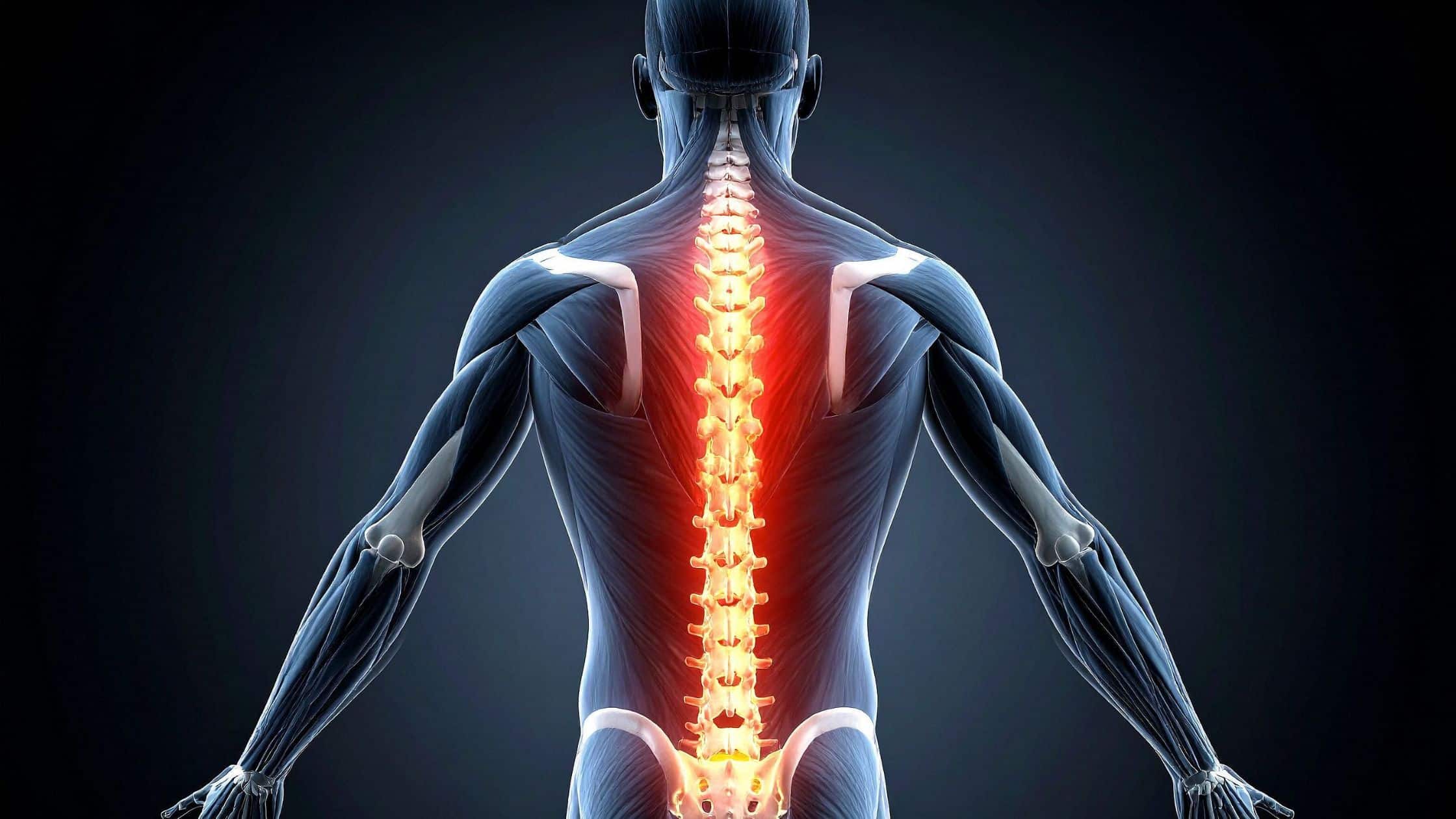 spinal stenosis